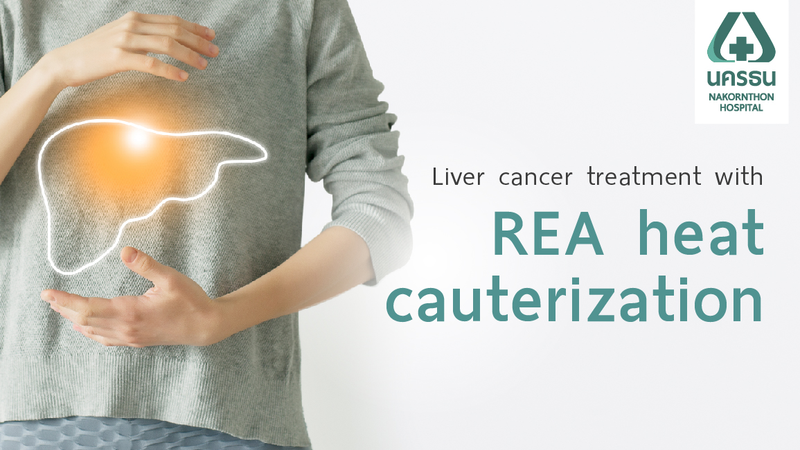 Liver RFA for Tumors